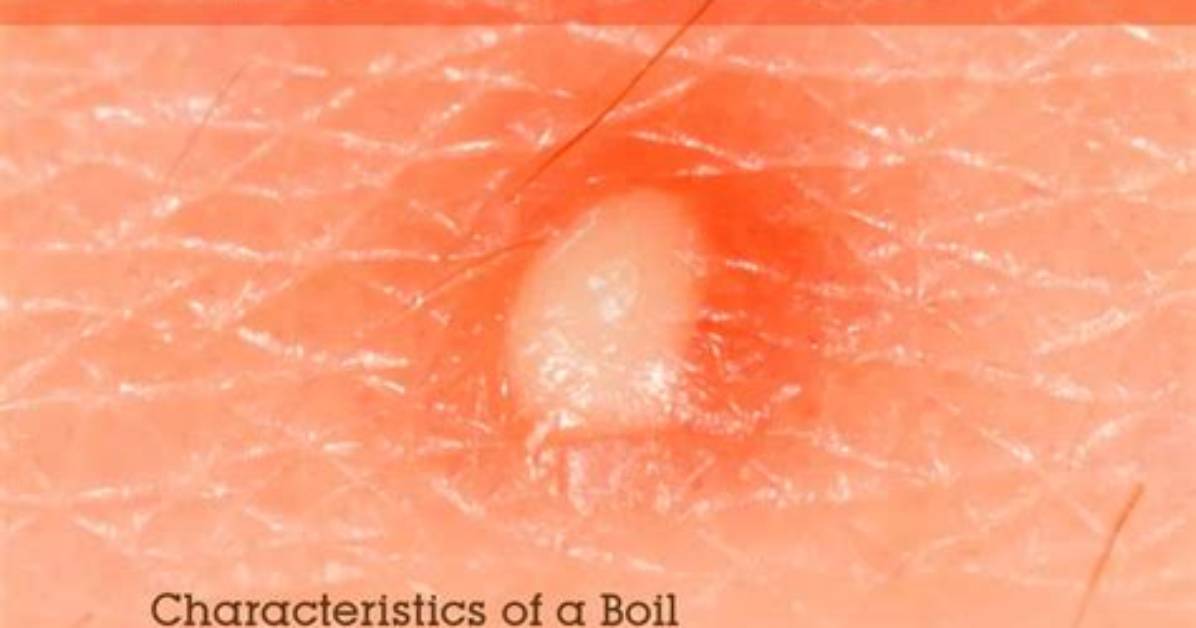 What Is the Difference Between Boil and Simmer?