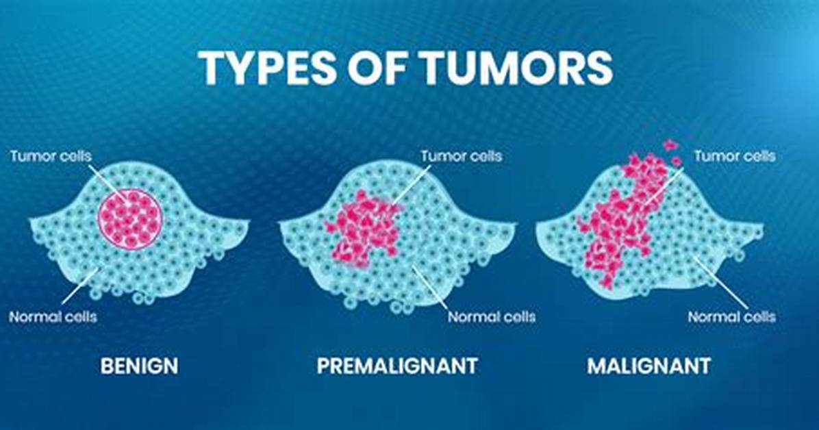 What Is the Difference Between Premalignant and Precancerous?
