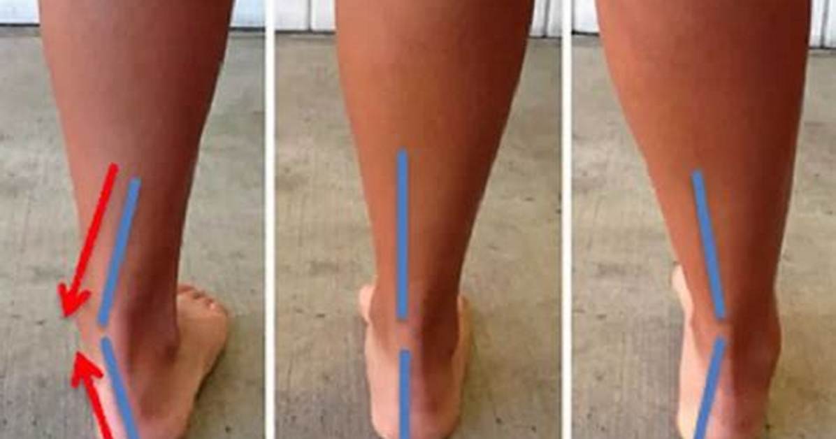 What Is the Difference Between Pronation and Supination?