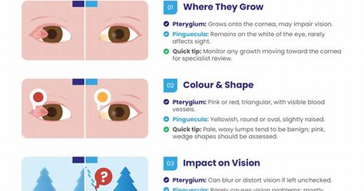 What Is the Difference Between Pterygium and Pinguecula?