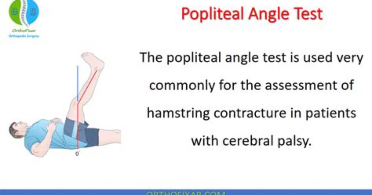 What Is the Popliteal Angle?