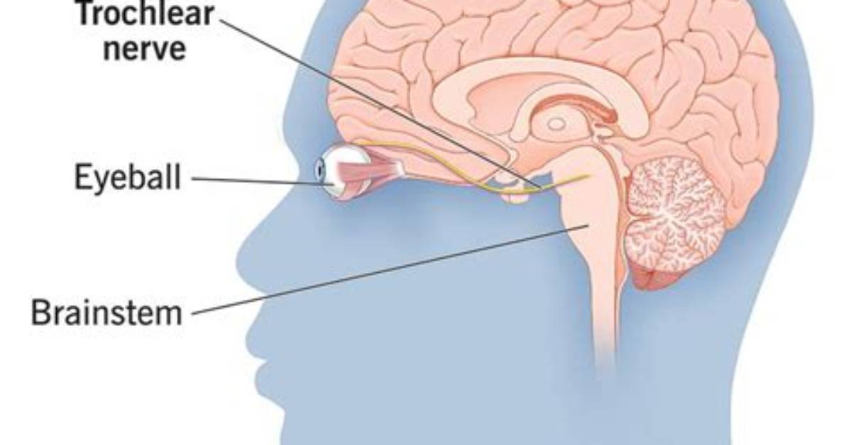 What Is the Trochlear?