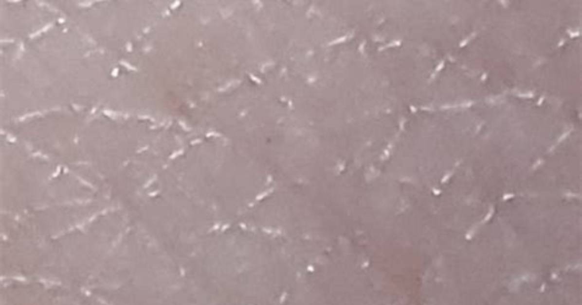 What Is the White Hard Stuff Under My Toenails?
