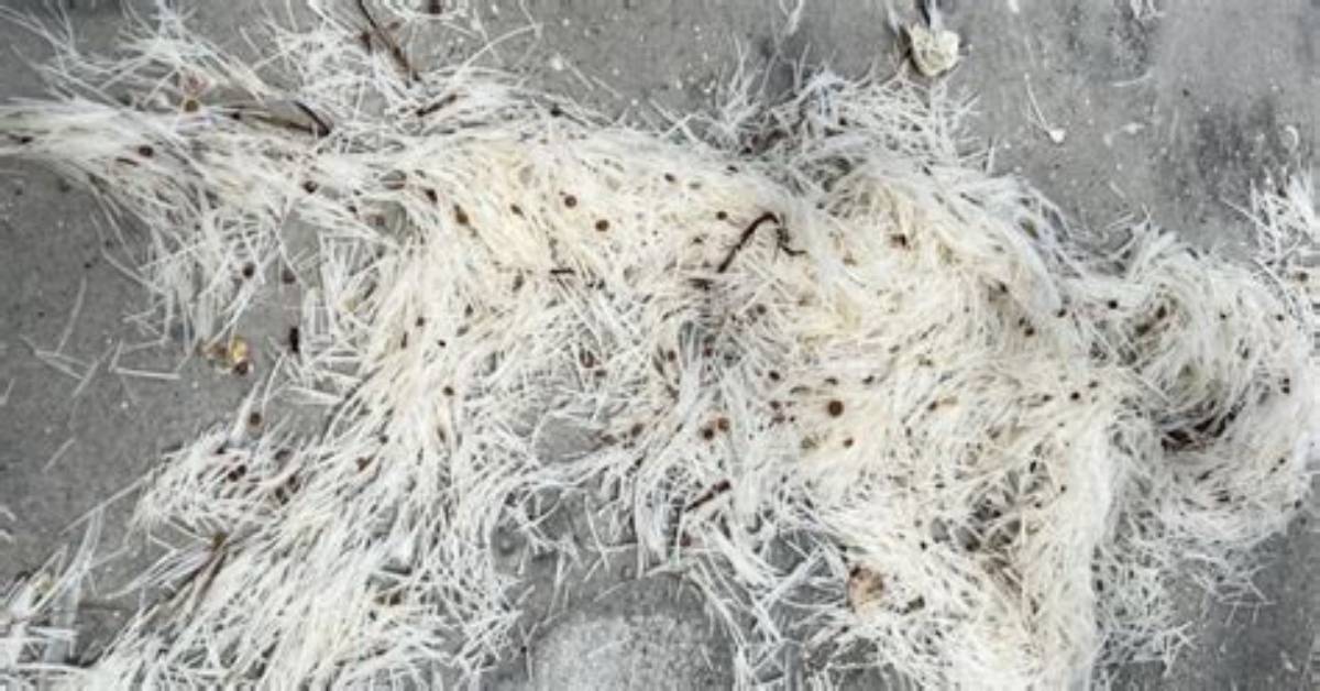 What Is the White Stringy Stuff That Comes out of a Cyst?