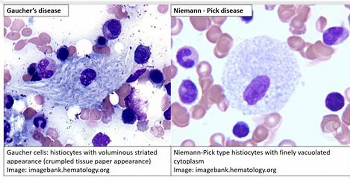 What Is Tissue Histiocyte?