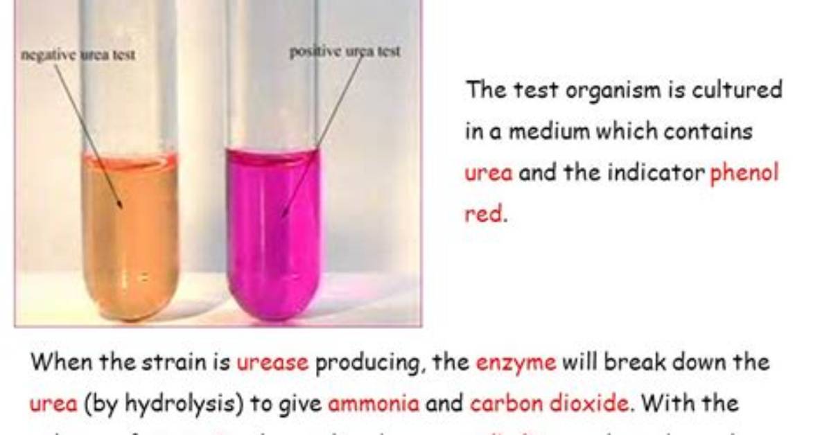 What Is Urease Test?