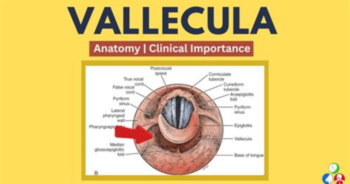 What Is Vallecular Pooling?