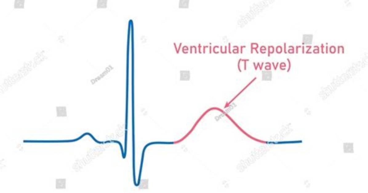 What Is Ventricular Repolarization