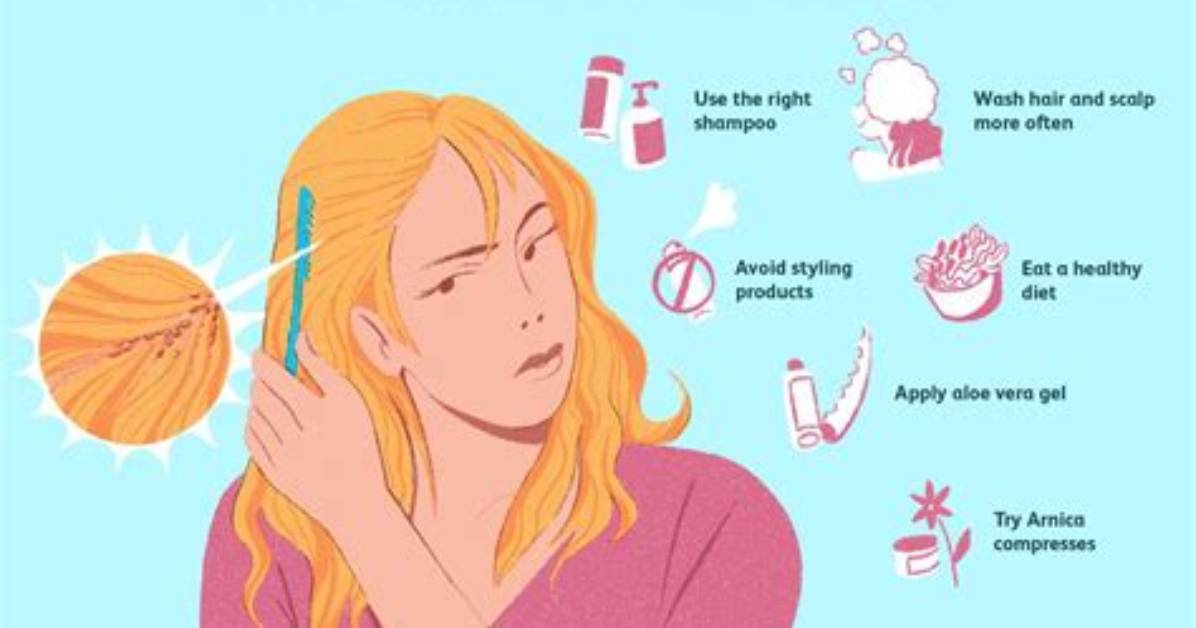 What Is Wet Dandruff? Here’s a Breakdown of Its Causes, Treatment, and Prevention