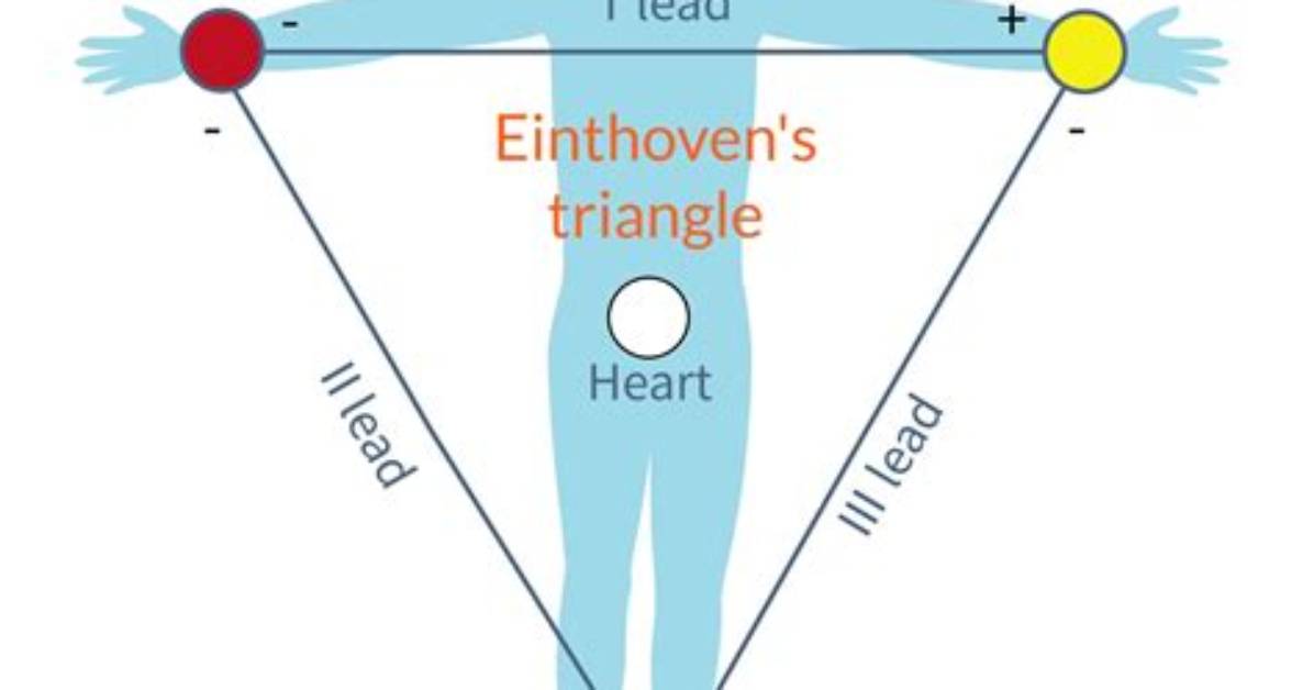 What Leads Makeup the Einthovens Triangle