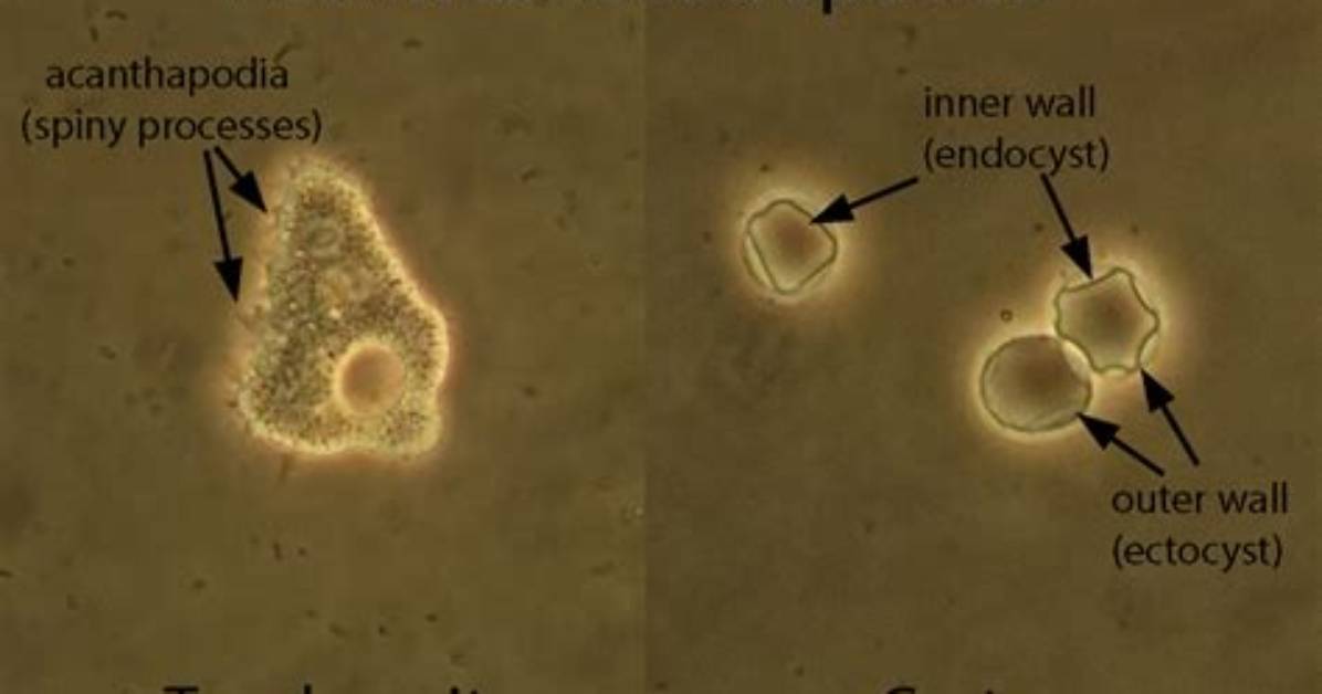 What Makes Acanthamoeba Cyst?