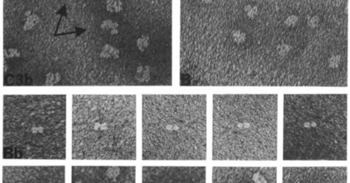 What Makes Electron Micrographs?