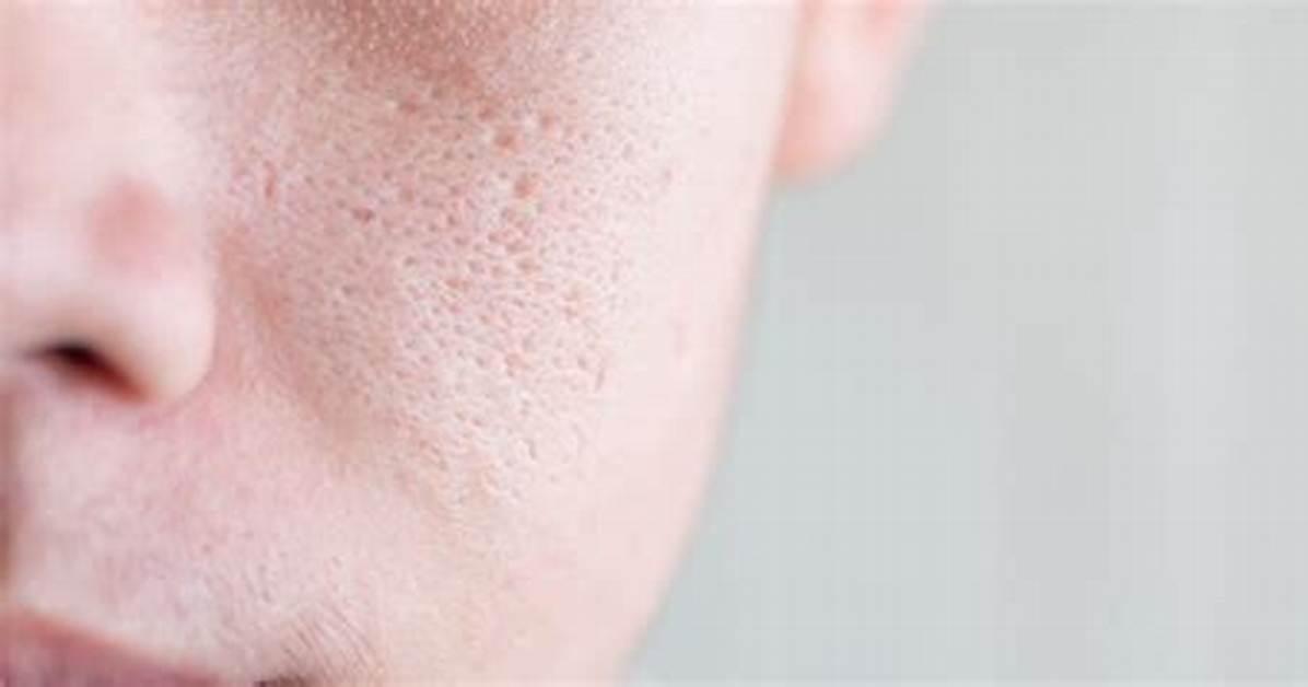 What Opens Your Pores? | Contextresponse. Com