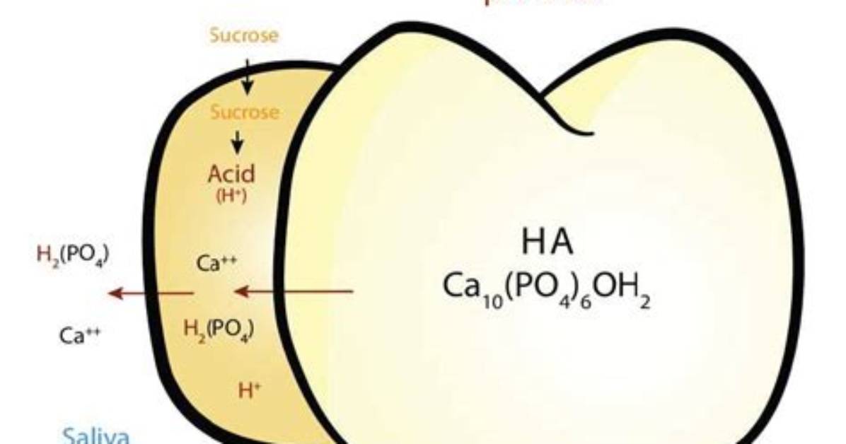 What Ph Does Enamel Demineralize?