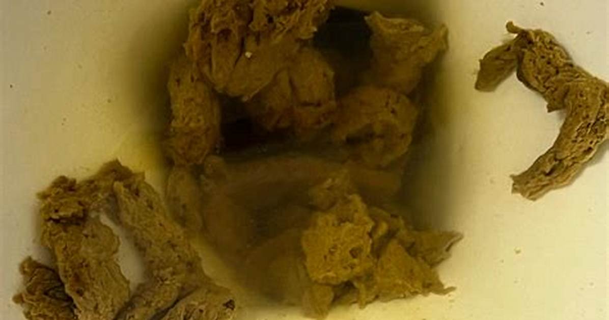 What Poop Looks Like When You Have Worms?