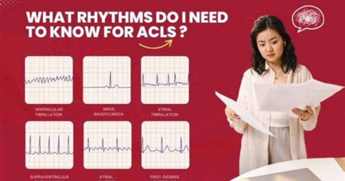 What Rhythms Do You Defibrillate?