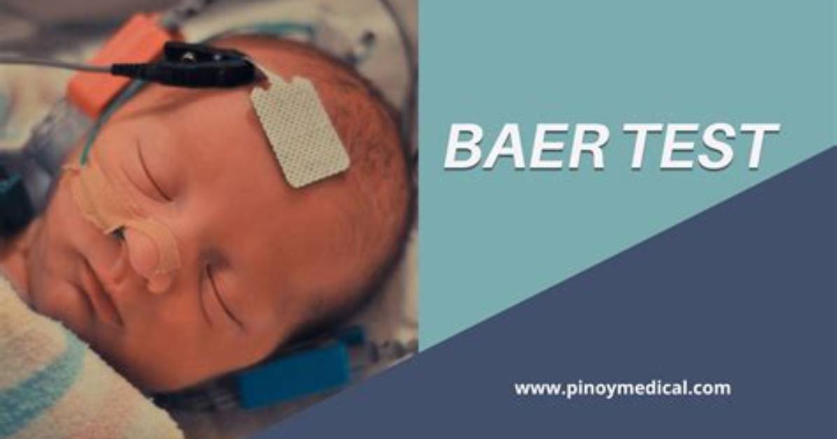 What's a Baer Test?