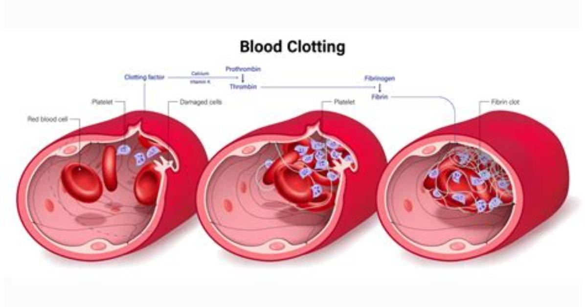What's a Clotting Screen?