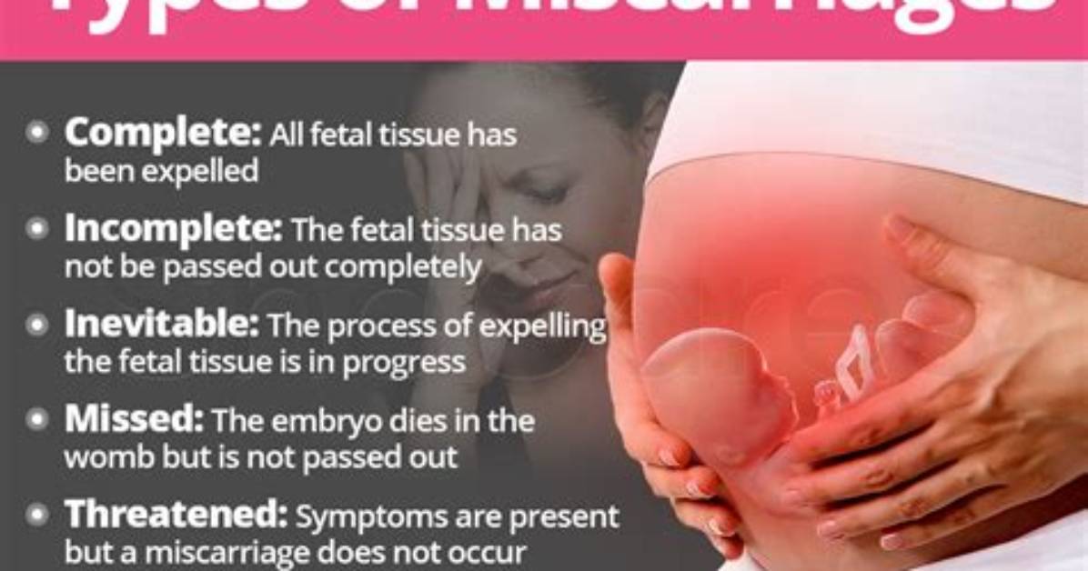 What's a D&C for Miscarriage?