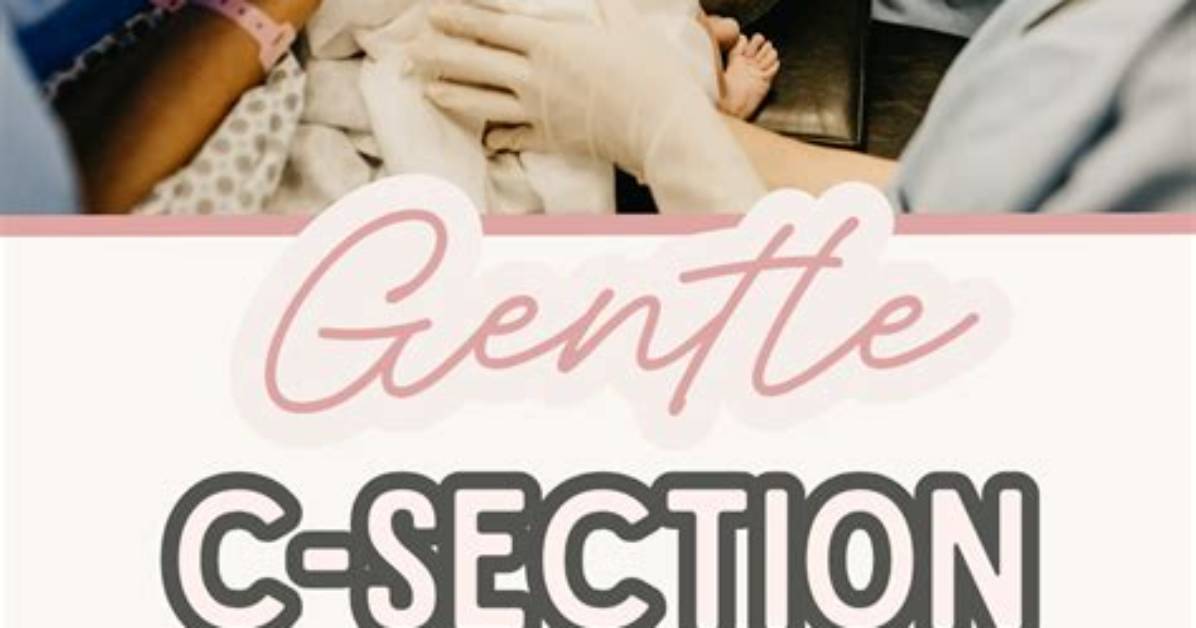 What's a Gentle C Section?