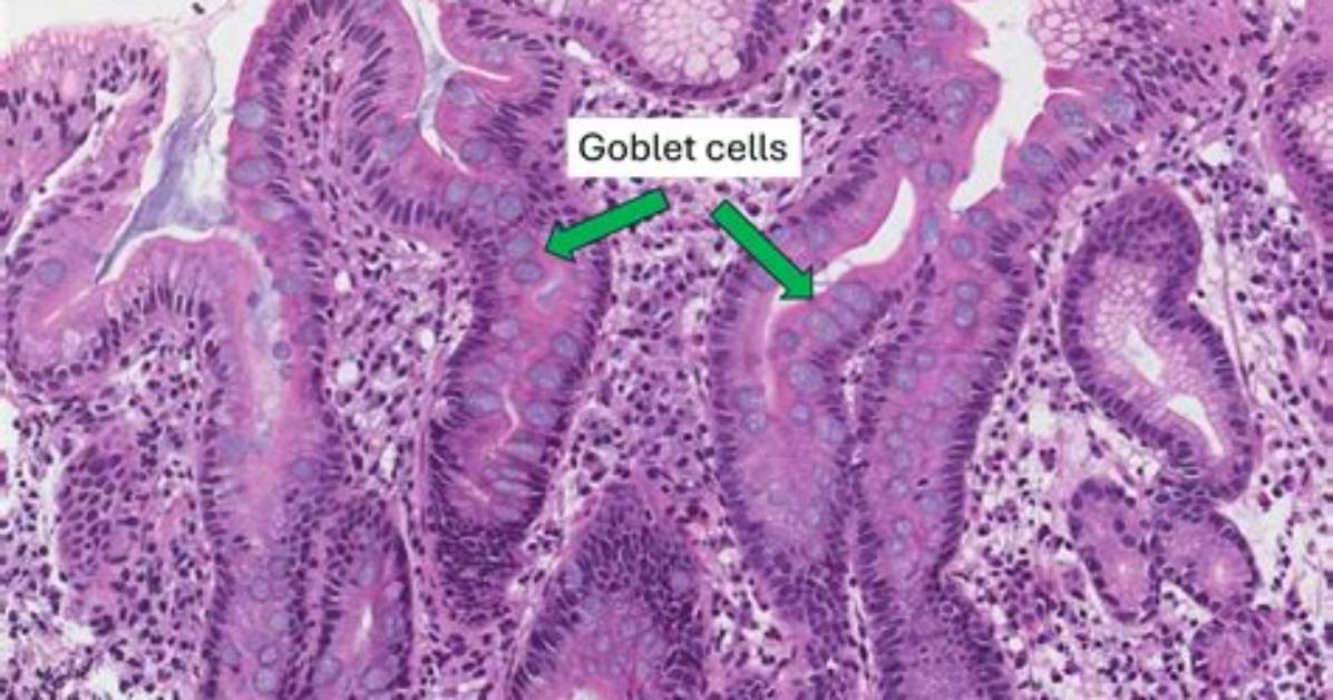 What's a Goblet Cell?