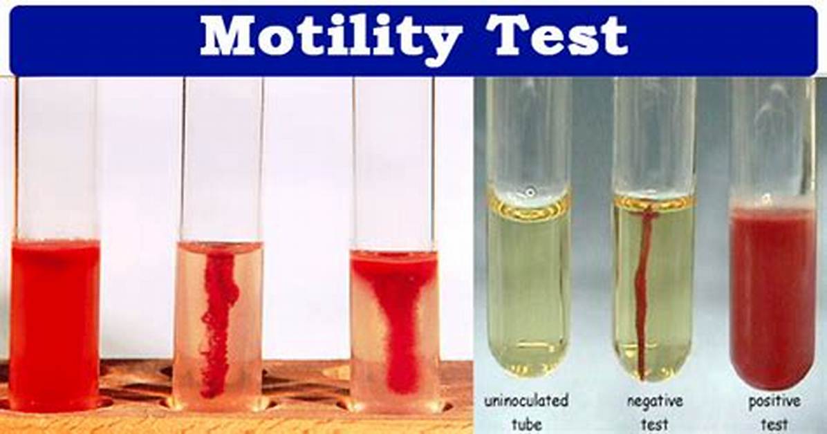 What's a Motility Test?
