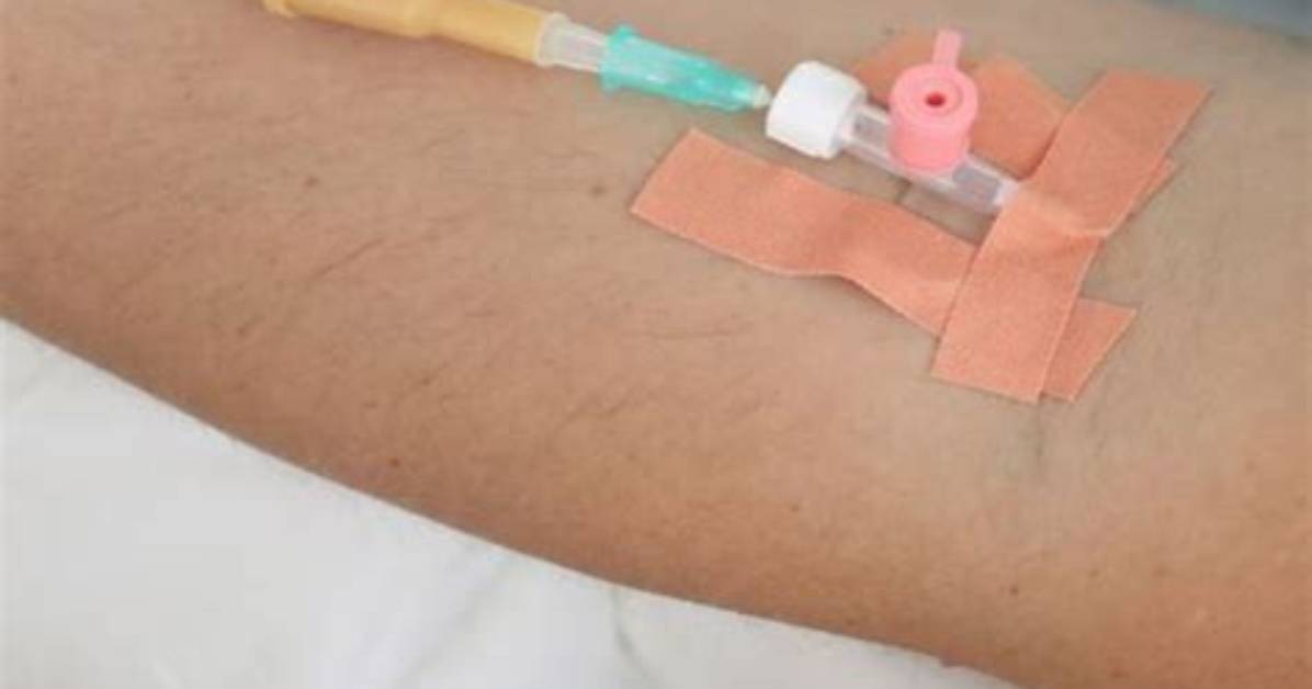 What's a Peripheral Iv?
