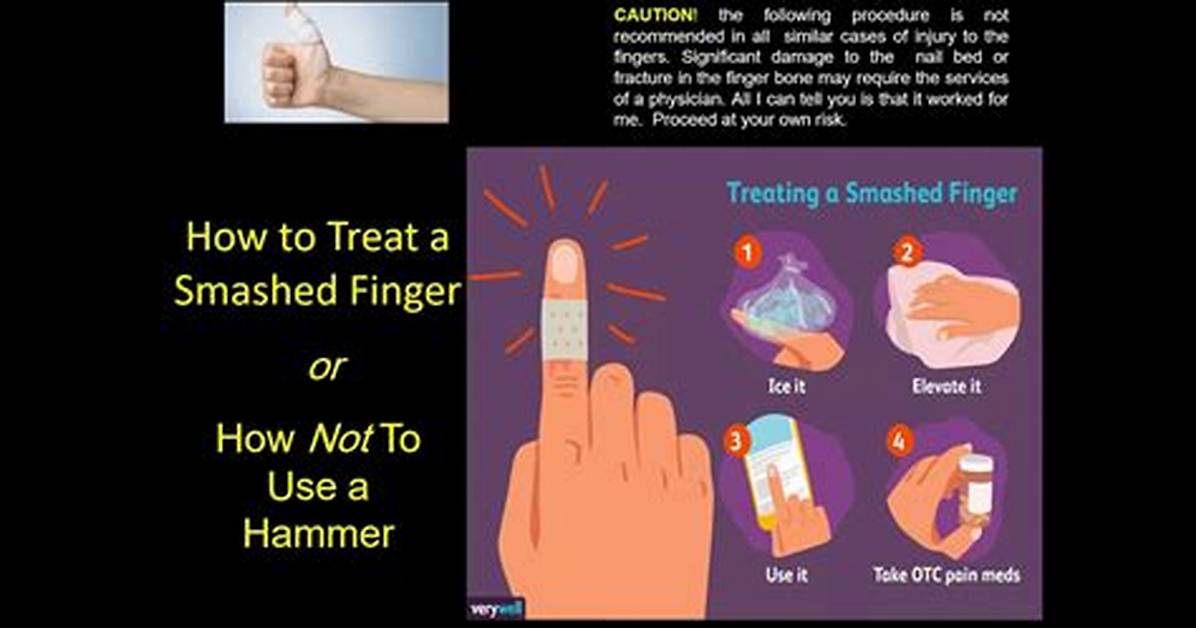 What's a Smashed Finger?
