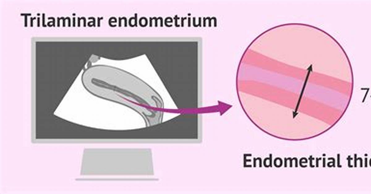 What's a Thick Endometrium?
