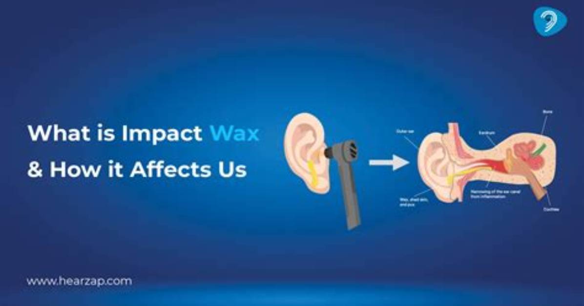 What's an Impacted Ear?