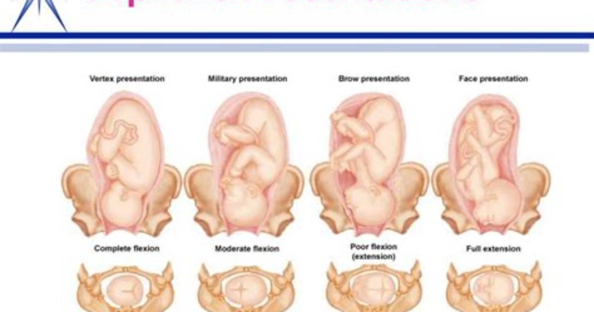 What's Cephalic Presentation Mean?