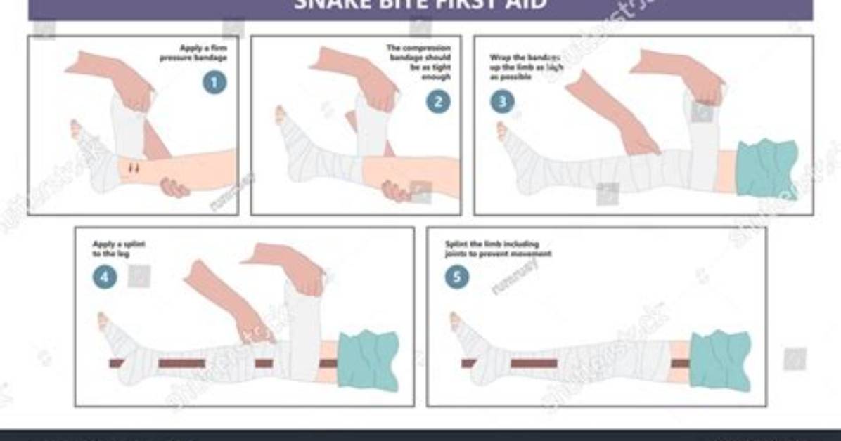 What's in a Snakebite Kit?