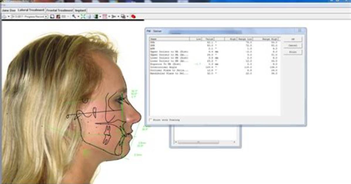 What Software Opens Vp3