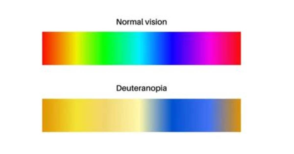 What the Difference Between Protanopia and Deuteranopia?