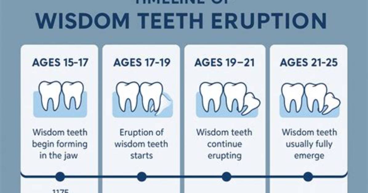 What to Do When Wisdom Teeth Come in?