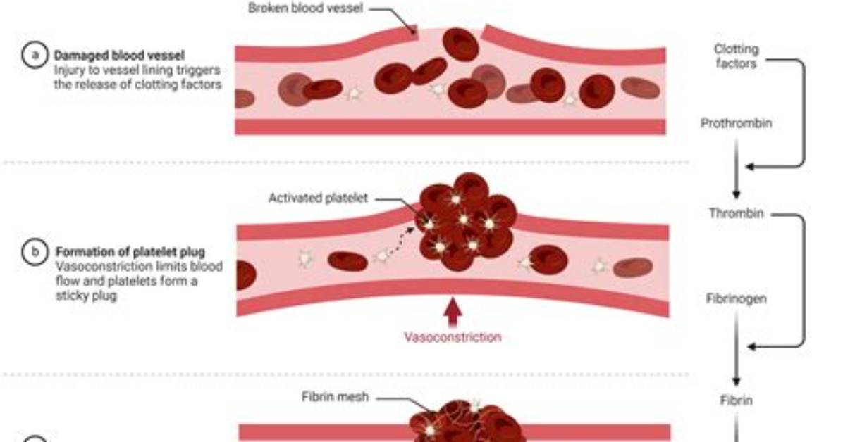 What Triggers Hemostasis