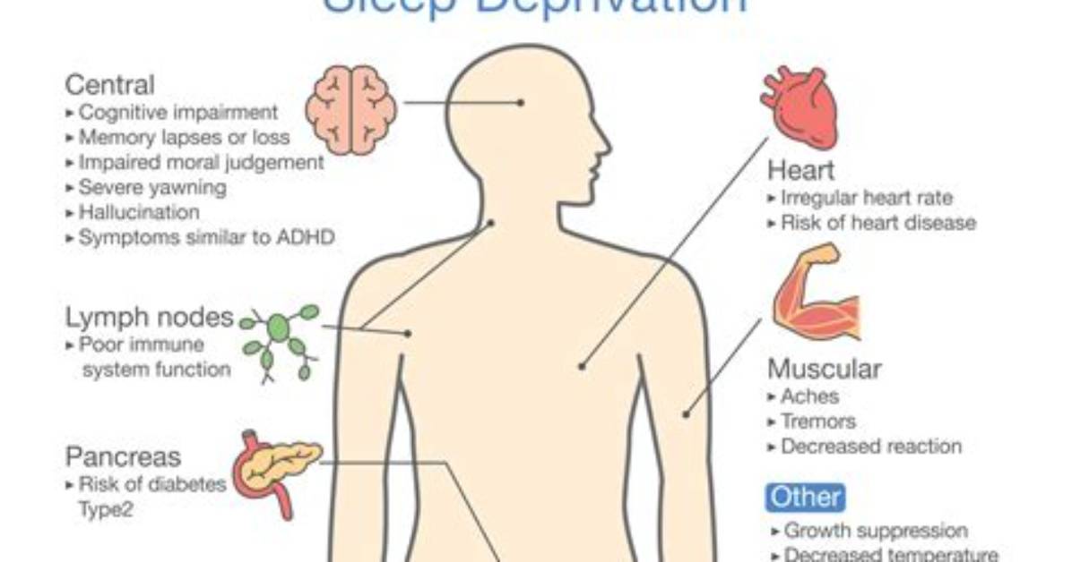 What Undersleeping Does to Your Body?