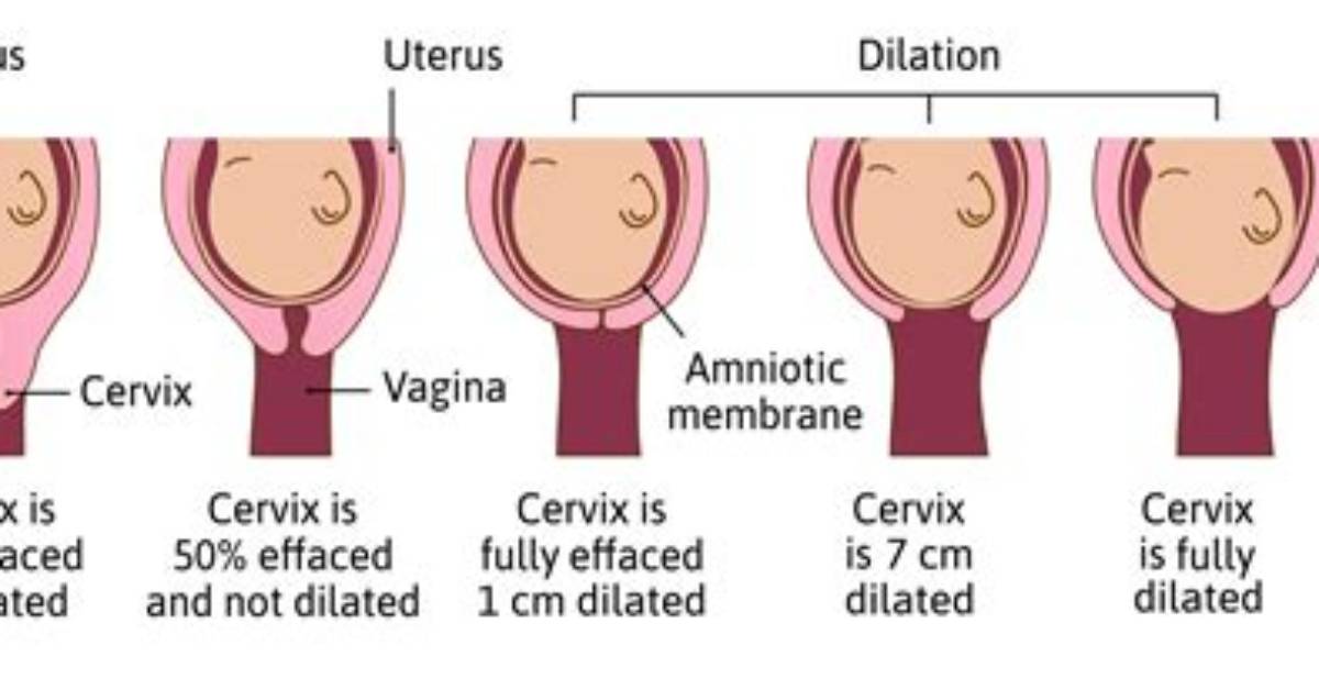 What Week Do You Start Dilating?