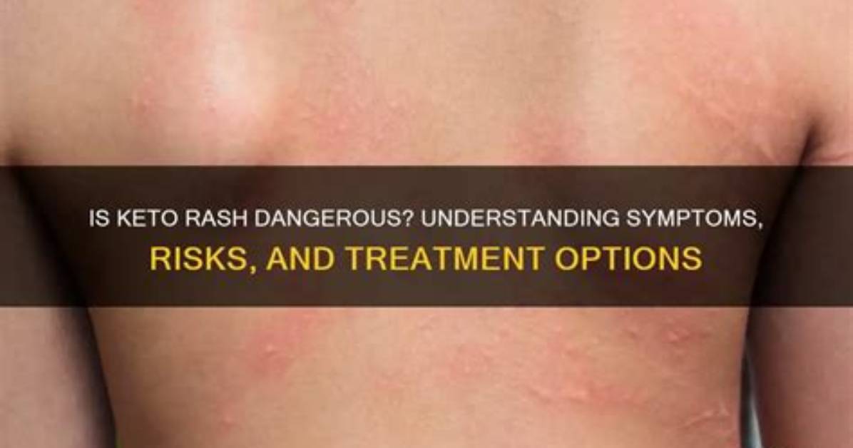 When a Rash Is Dangerous