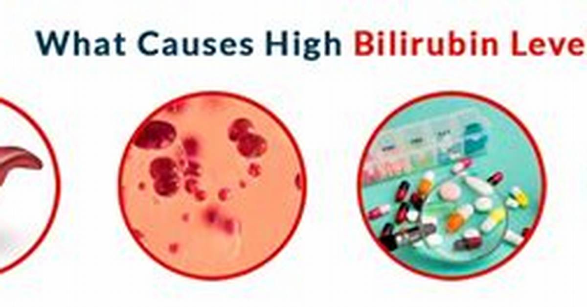 When Bilirubin Is High?