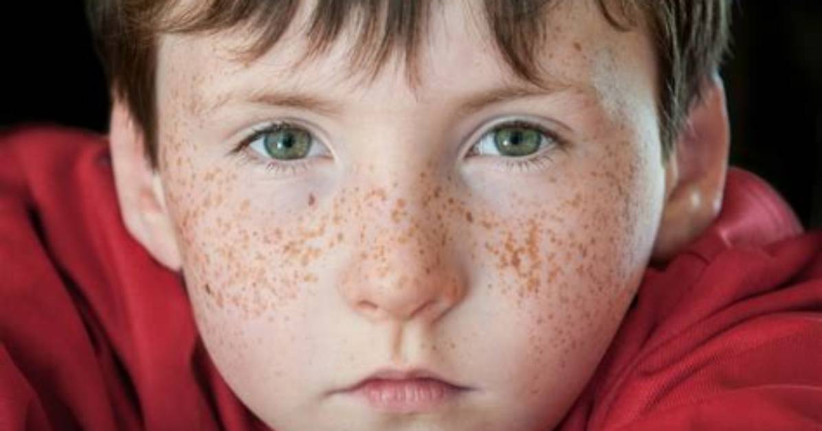 When Can Babies Get Freckles?