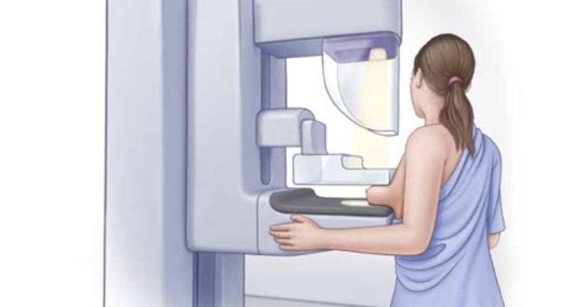 When Can I Get a Mammogram?