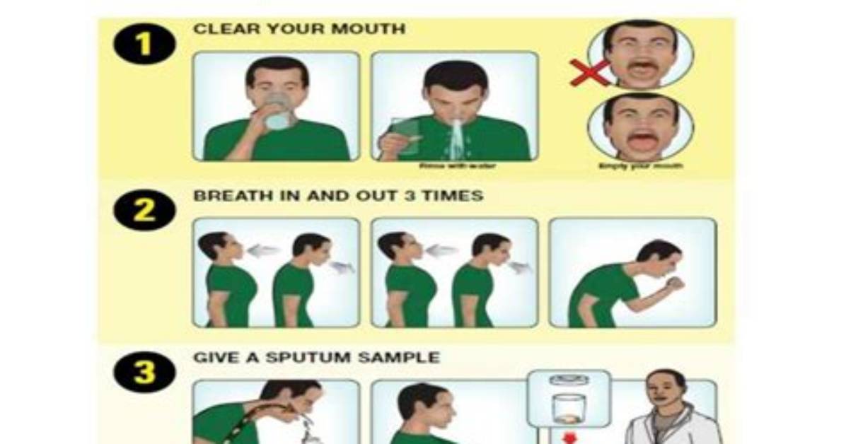When Collecting a Sputum Specimen?