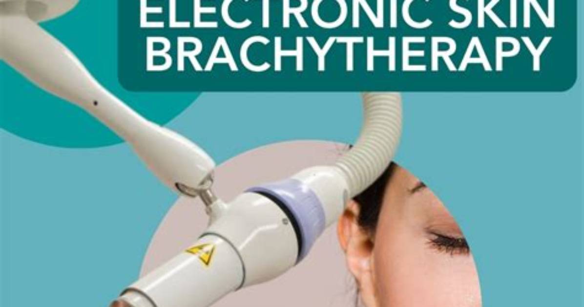 When Did Brachytherapy Start?