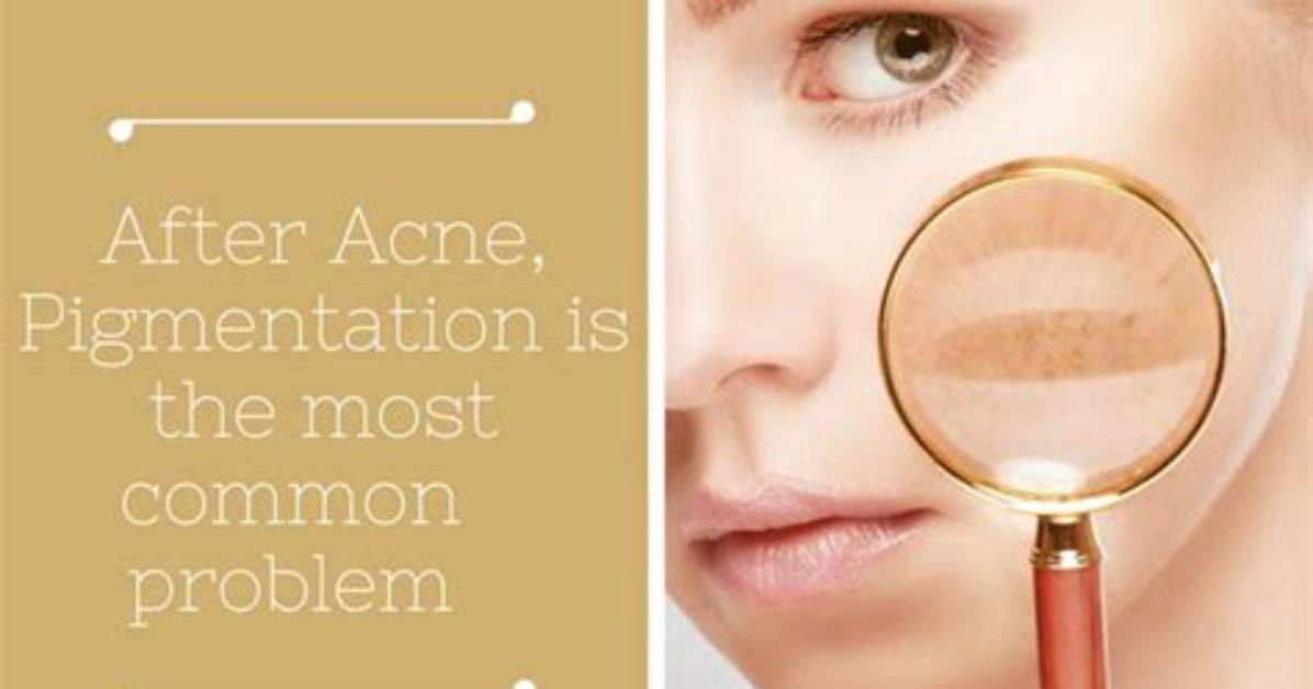 When Did Pigmentation Begin?