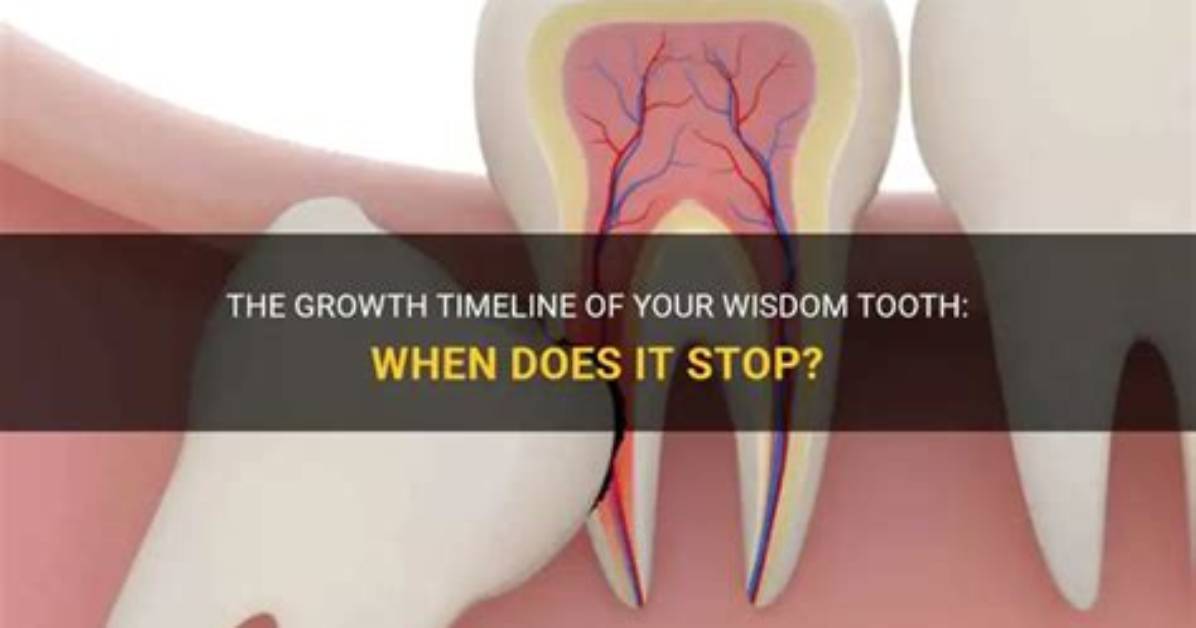 When Do Teeth Stop Growing?