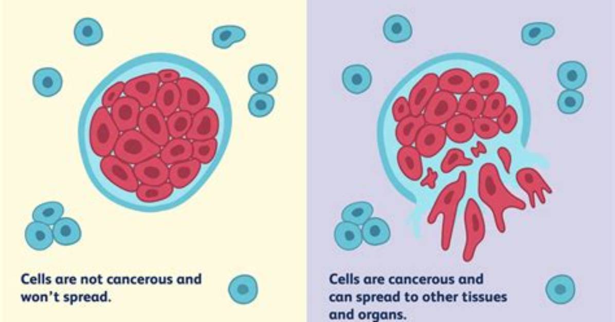 When Do Tumours Become Dangerous?