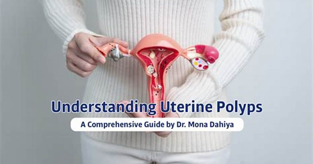 When Do Uterine Polyps Need to Be Removed?