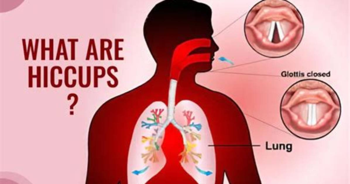When Do You Get Hiccups?