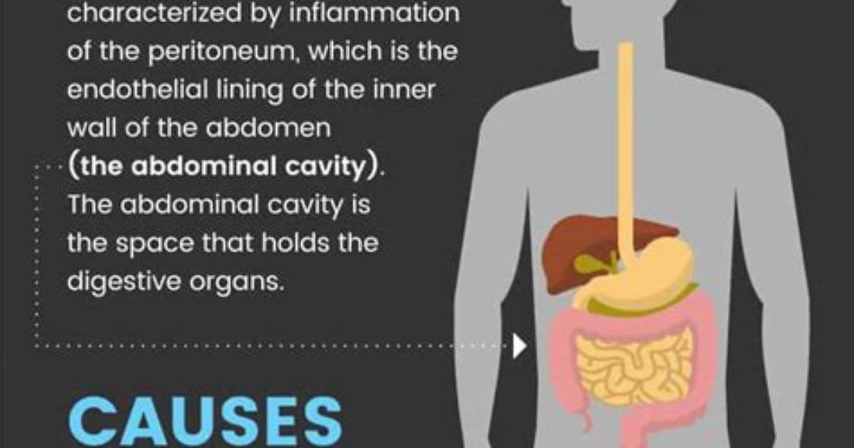 When Do You Get Peritonitis?